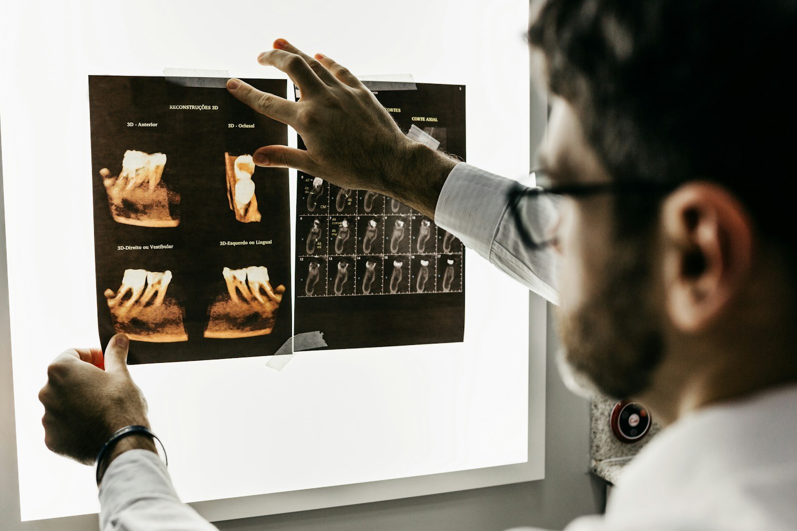 A dentist reviewing 3D dental scans on a lightbox at Arc Dental Studio